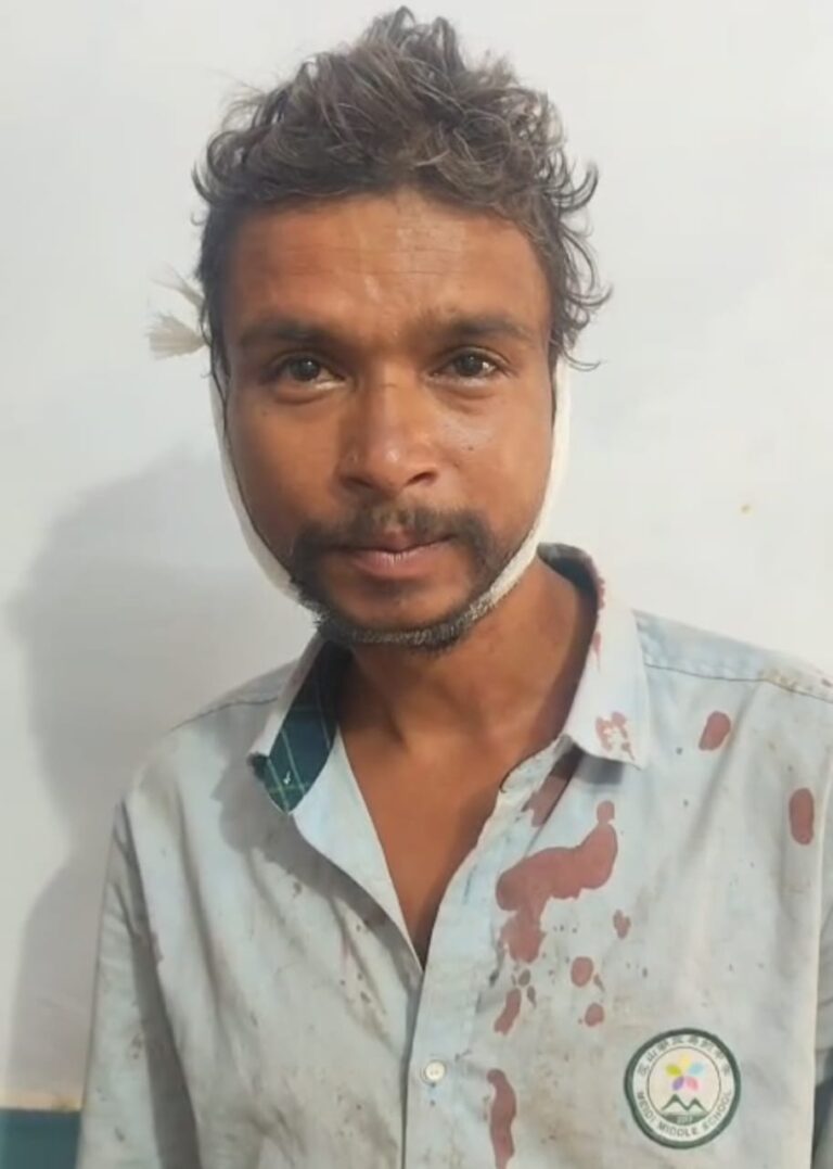 नशेबाजी में मारा धक्का, ट्रॉली से टकरा कर सिर फटा